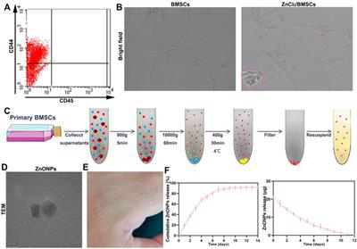 Bioengineered Zinc Oxide Nanoparticle-Loaded Hydrogel for Combinative Treatment of Spinal Cord Transection